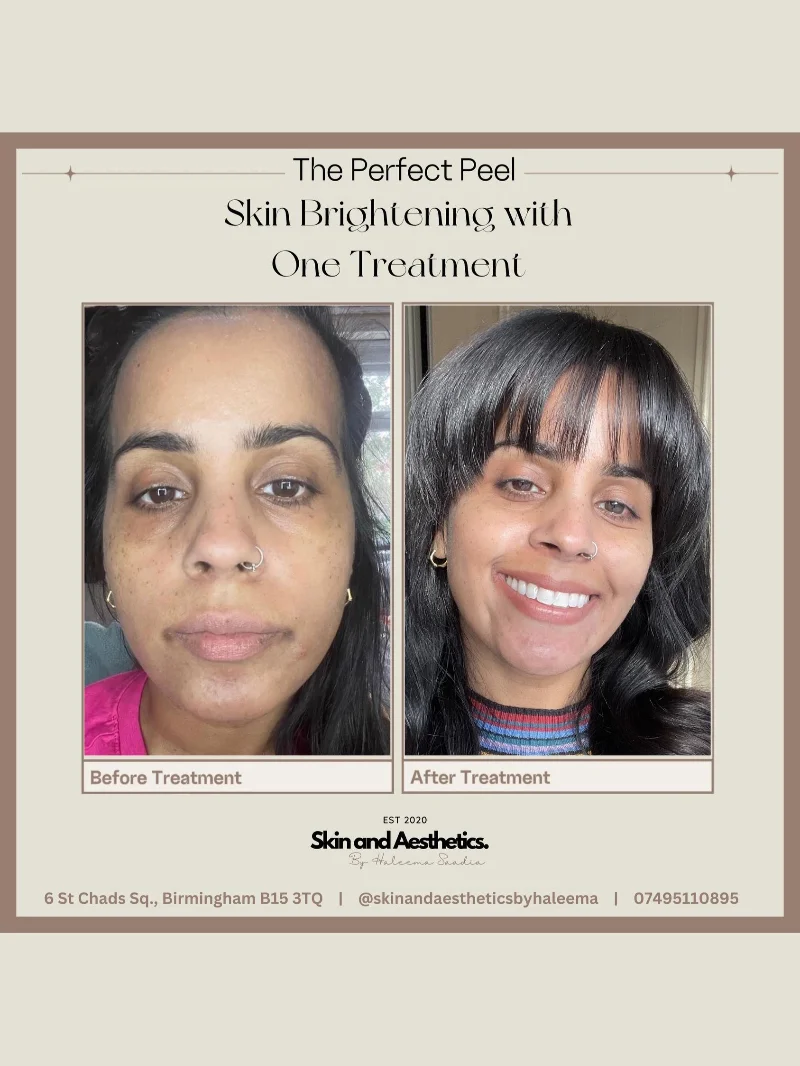 Skin aesthetics result